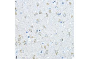 Immunohistochemistry of paraffin-embedded rat brain using IDS Rabbit pAb (ABIN3015633, ABIN3015634, ABIN3015635 and ABIN6218988) at dilution of 1:200 (40x lens). (IDS anticorps  (AA 34-290))