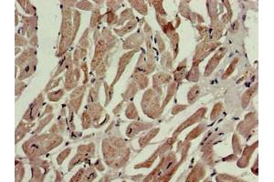 IHC analysis of paraffin-embedded human heart tissue, using P4HA1 antibody (1/100 dilution).
