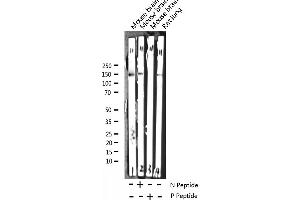 Western blot analysis of Phospho-Trk B (Tyr705) expression in various lysates (TRKB anticorps  (pTyr706))