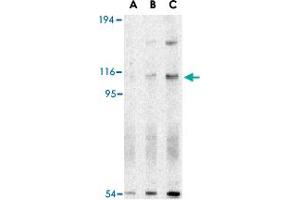Western blot analysis of ERN1 in A-20 cell lysate with ERN1 polyclonal antibody  at (A) 0. (ERN1 anticorps  (N-Term))