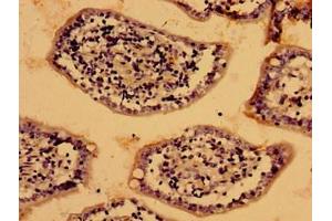 Immunohistochemistry of paraffin-embedded human small intestine tissue using ABIN7158451 at dilution of 1:100
