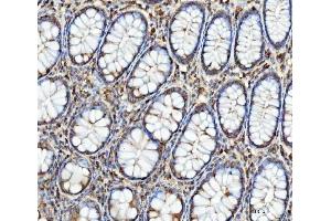 IHC analysis of FATP4/SLC27A4 using anti-FATP4/SLC27A4 antibody (ABIN7600117).