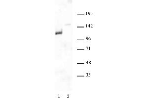 Androgen Receptor antibody (pAb) tested by Western blot.