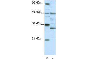 Western Blotting (WB) image for anti-Forkhead Box N2 (FOXN2) antibody (ABIN2461648) (FOXN2 anticorps)