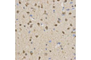 Immunohistochemistry (IHC) image for anti-Transducin-Like Enhancer of Split 1 (E(sp1) Homolog, Drosophila) (TLE1) antibody (ABIN1876687) (TLE1 anticorps)
