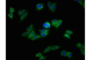 Immunofluorescence staining of HepG2 cells with ABIN7170398 at 1:213, counter-stained with DAPI. (SNX5 anticorps  (AA 7-245))