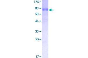 Image no. 1 for GATA Binding Protein 2 (GATA2) (AA 1-480) protein (GST tag) (ABIN1354830)
