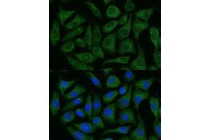 Immunofluorescence analysis of L929 cells using R Polyclonal Antibody (ABIN7269849) at dilution of 1:100 (40x lens).