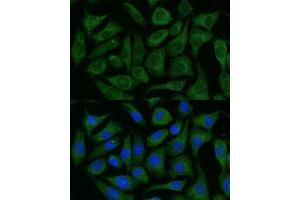 Immunofluorescence analysis of L929 cells using R Polyclonal Antibody (ABIN7269849) at dilution of 1:100 (40x lens). (GRF2 anticorps  (AA 844-1095))