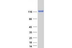 Validation with Western Blot