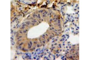Used in DAB staining on fromalin fixed paraffin-embedded Lung tissue (IL-18 anticorps  (AA 36-192))
