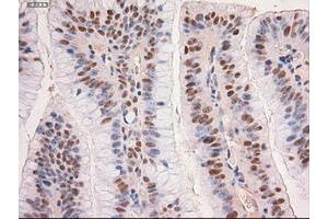 Image no. 3 for anti-Myc Proto-Oncogene protein (MYC) antibody (ABIN1497013) (c-MYC anticorps)
