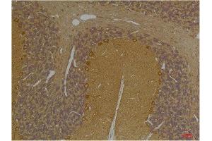 Immunohistochemistry (IHC) analysis of paraffin-embedded Rat Brain Tissue using SLC12A4 Rabbit Polyclonal Antibody diluted at 1:200.