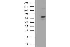 Western Blotting (WB) image for anti-Pyruvate Kinase, Liver and RBC (PKLR) antibody (ABIN1500248) (PKLR anticorps)