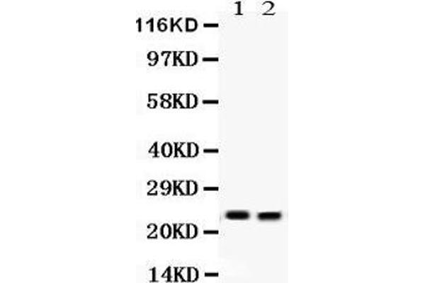 Lipocalin 2 anticorps  (AA 21-198)