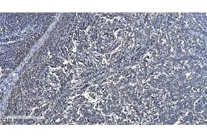 IHC analysis of VDAC3 using anti-VDAC3 antibody (ABIN7602541).