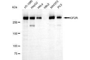 Western blotting analysis using IGF2R antibody (ABIN7799053). (Recombinant IGF2R anticorps)