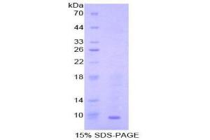 SDS-PAGE (SDS) image for Chemokine (C-C Motif) Ligand 22 (CCL22) (AA 29-92) protein (His tag) (ABIN1877293)