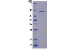 SDS-PAGE (SDS) image for N-Acetyltransferase 8-Like (GCN5-Related, Putative) (NAT8L) (AA 1-302) protein (His tag) (ABIN6237652)
