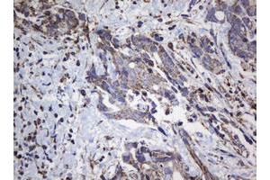 Image no. 7 for anti-NADH Dehydrogenase (Ubiquinone) 1 beta Subcomplex, 10, 22kDa (NDUFB10) antibody (ABIN1499672) (NDUFB10 anticorps)