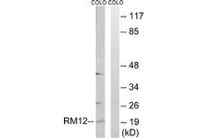 Western blot analysis of extracts from COLO cells, using MRPL12 Antibody. (MRPL12 anticorps  (AA 31-80))