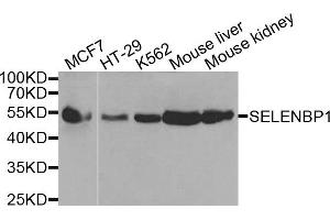 Western blot analysis of extracts of various cells, using SELENBP1 antibody. (SELENBP1 anticorps)