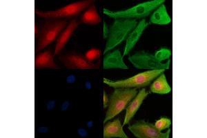 Phospho-TAO2 (Ser181) Antibody staining A549 cells(H2O2 treatment) by IF/ICC. (TAO Kinase 2 anticorps  (pSer181))