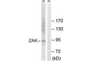 Western blot analysis of extracts from Jurkat cells, using ZAK (Ab-165) Antibody. (ZAK anticorps  (AA 131-180))