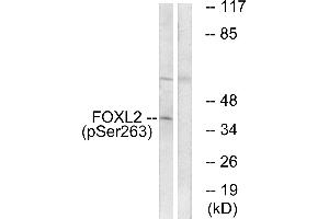 Western blot analysis of extracts from K562 cells, treated with Na3VO4 (0.