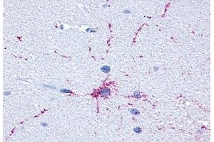 Anti-GRM8 / MGLUR8 antibody  ABIN1048946 IHC staining of human brain, neurons and glia.