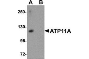 Western blot analysis of ATP11A in K562 cell tissue lysate with ATP11A antibody at 1 μg/ml in (A) the absence and (B) the presence of blocking peptide. (ATP11A anticorps  (N-Term))
