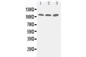 Anti-Zonula occludens protein 3 antibody, Western blotting Lane 1: PANC Cell Lysate Lane 2: A549 Cell Lysate Lane 3: HELA Cell Lysate (TJP3 anticorps  (C-Term))