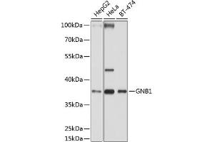 Western blot analysis of extracts of various cell lines, using GNB1 antibody (ABIN6129389, ABIN6141219, ABIN6141220 and ABIN6219000) at 1:1000 dilution. (GNB1 anticorps  (AA 1-340))