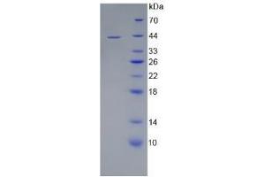 SDS-PAGE of Protein Standard from the Kit  (Highly purified E. (CD4 Kit ELISA)