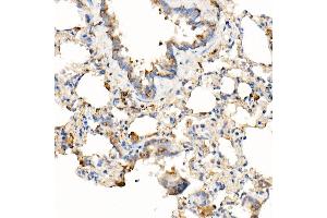 Immunohistochemistry of paraffin-embedded rat lung using [KO Validated] MyD88 Rabbit mAb (ABIN7268723) at dilution of 1:1000 (40x lens).