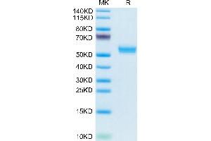 Cynomolgus BAFF Trimer on Tris-Bis PAGE under reduced condition.