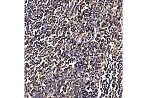 Immunohistochemistry of paraffin-embedded human tonsil using C Rabbit pAb (ABIN6130035, ABIN6137891, ABIN6137892 and ABIN6220925) at dilution of 1:100 (40x lens). (CAMK4 anticorps  (AA 304-473))