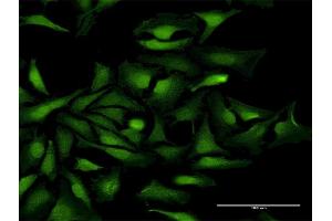 Immunofluorescence of purified MaxPab antibody to KIAA0101 on HeLa cell.