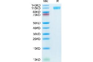 SARS-CoV-2 Spike S1 (E484K), (K417N), (N501Y) protein (His tag)