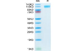 SDS-PAGE (SDS) image for SARS-CoV-2 Spike S1 (E484K), (K417N), (N501Y) protein (His tag) (ABIN7274391)