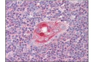 Human Thymus (formalin-fixed, paraffin-embedded) stained with RGS1followed by biotinylated anti-goat IgG secondary antibody, alkaline phosphatase-streptavidin and chromogen. (RGS1 anticorps  (C-Term))