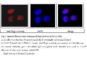 Immunofluorescence (IF) image for anti-SWI/SNF Related, Matrix Associated, Actin Dependent Regulator of Chromatin, Subfamily A, Member 4 (SMARCA4) (C-Term) antibody (ABIN2451926)