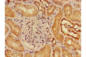 Immunohistochemistry of paraffin-embedded human kidney tissue using ABIN7160177 at dilution of 1:100 (SLC16A9 anticorps  (AA 185-304))