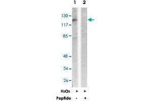 Western blot analysis of extracts from LoVo cells, treated with H 2 O 2  (100 uM, 30 mins), using PDGFRB polyclonal antibody . (PDGFRB anticorps)