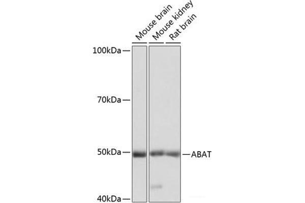 ABAT anticorps