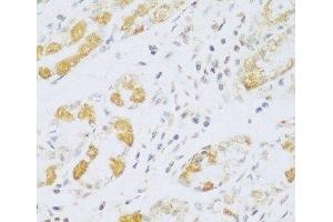 Immunohistochemistry of paraffin-embedded Human stomach using FDXR Polyclonal Antibody at dilution of 1:100 (40x lens). (Ferredoxin Reductase anticorps)