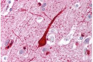 Human Brain, Cortex (formalin-fixed, paraffin-embedded) stained with E2F4 antibody ABIN214109 at 5 ug/ml followed by biotinylated goat anti-rabbit IgG secondary antibody ABIN481713, alkaline phosphatase-streptavidin and chromogen.
