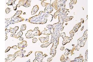 IHC analysis of HP using anti-HP antibody (ABIN7600401).