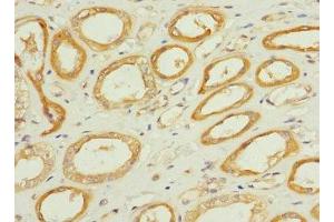 Immunohistochemistry of paraffin-embedded human kidney tissue using ABIN7171975 at dilution of 1:100 (TPK1 anticorps  (AA 1-243))