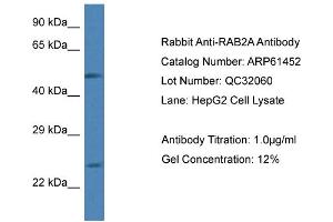 Western Blotting (WB) image for anti-RAB2A, Member RAS Oncogene Family (RAB2A) (C-Term) antibody (ABIN786424) (RAB2A anticorps  (C-Term))